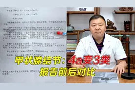 甲状腺结节缩小降级，前后报告单对比，老中医讲解治疗过程
