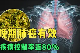 这款靶向新药主要用于晚期肺癌，疾病控制率近80%，快收藏！视频封面