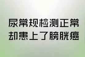 【抗癌有道】尿检报告一切正常，转年查出膀胱癌，你别再被骗了！视频封面