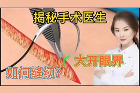 医学演绎 外科医生是如何在手术缝纫患者肌肤 医术精湛 大揭秘视频封面