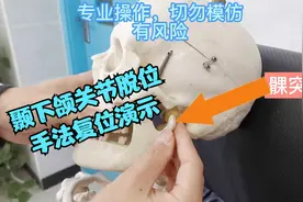 颞下颌关节为什么会脱位，如何复位，沈医生为你讲解，手法演示。视频封面