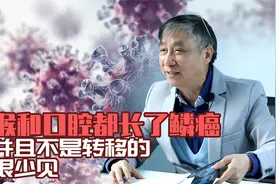 【纪小龙医学科普】喉和口腔都长了鳞癌 并且不是转移的 很少见视频封面