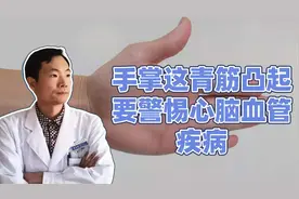 手掌这有青筋凸起，是身体发出的警示信号，要小心心脑血管疾病