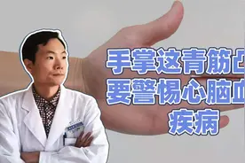 手掌这有青筋凸起，是身体发出的警示信号，要小心心脑血管疾病视频封面