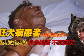 狂犬病患者真实发病录像，一旦感染真的很恐怖｜爱狗人士须谨慎视频封面