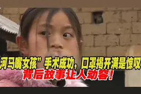 “河马嘴女孩”手术成功，口罩揭开满是惊叹，背后故事让人动容！视频封面