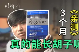 想长头发长胡子？亲测使用落健，挑战3个月实录长胡子#vlog01视频封面