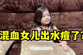 女儿身上突然出现红疹，去伊朗医院检查说是水痘，到底啥情况？视频封面