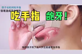 孩子爸爸一注意了，孩子喜欢吃手指，会导致牙齿畸形！视频封面
