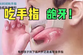 孩子爸爸一注意了，孩子喜欢吃手指，会导致牙齿畸形！视频封面