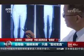 “直腿神器”热销 真管用还是“智商税”？这样做拥有健康美腿