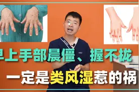 早晨起来手发胀，握不拢，活动活动就缓解！一定是类风湿惹的祸？视频封面