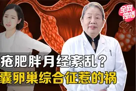 多囊卵巢综合征长啥样？这些异常要警惕，无法根治只能对症下药视频封面