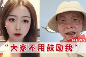 四川烧伤女孩经历12次手术重生，开直播透露近况：请把我当正常人视频封面