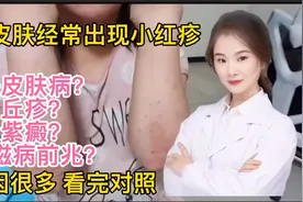 身体皮肤经常出现小红疹艾滋病前兆？丘疹？紫癜原因很多检查对照