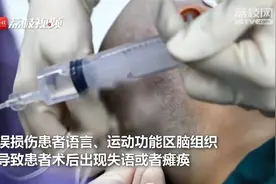 医生边做手术边与病人聊天！常州首例“术中唤醒”开颅手术很成功