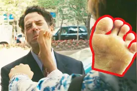 60s科普：为什么有脚气的人50度开水泡脚很爽？其实爽的不是你！视频封面