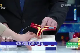一颗“金刚钻”打通冠状动脉血管，攻克冠脉严重钙化|健康山东视频封面