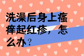 洗澡后身上瘙痒起红疹，怎么办？视频封面