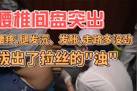 腰椎间盘突出,腰疼,腿发沉、发胀,走路多没劲,拔出了拉丝的"浊"视频封面