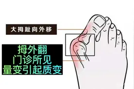 #量变质变 #拇外翻 #大脚骨 #脚趾分开 #健康科普视频封面