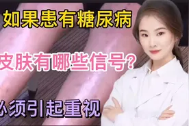 中老年患有糖尿病患者皮肤上有什么信号特征？如何预防和保健珍藏视频封面