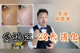 颧骨脸颊两侧的“黄褐斑”怎么去？科学高效方案，亲测有效视频封面