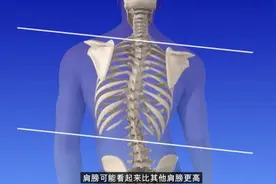 3D动画演示“脊柱侧弯”的形成，看完吓得我赶紧坐直了！