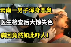 云南一男子浑身恶臭，医生检查后大惊失色，病因竟然如此吓人！视频封面
