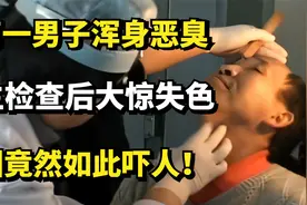 云南一男子浑身恶臭，医生检查后大惊失色，病因竟然如此吓人！视频封面