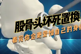看完这个股骨头置换手术演示，你会更爱惜自己的骨头！视频封面