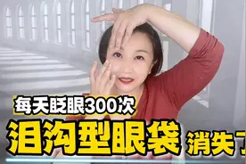 每天眨眼300次，泪沟型眼袋都可以解决，眼睛年轻多了，整脸好看视频封面