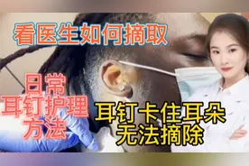 医学实录 耳钉卡住耳朵 看医生如何摘取 日常护理耳钉很重要