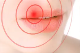 带状疱疹的原因找到了！免疫力下降在其中，第一位的很多人忽略了