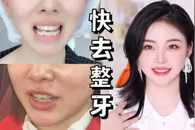 堪比换脸！整牙真的变好看，脸型都改变了！视频封面