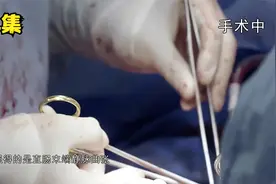 27岁小伙做心脏移植手术，全场人都冷汗一场最终主刀医生抢救回来视频封面