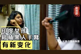 印度女孩因一场车祸失去双臂，移植黑人的手臂后，如今又有新变化视频封面