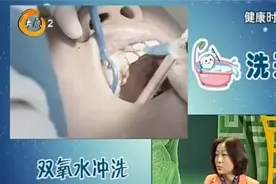健康时间：仅需40分钟！超声波洗牙分三步，能有效清理牙结石视频封面