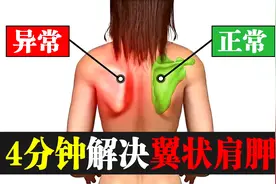 翼状肩胛骨怎么办？4分钟教你改善翼状肩胛，一周见效视频封面