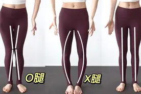 日本体态大师爆火矫正XO腿型｜轻松拥有细直美腿