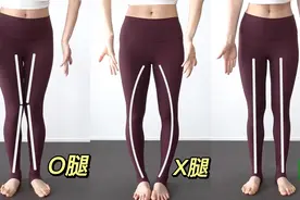 日本体态大师爆火矫正XO腿型｜轻松拥有细直美腿视频封面