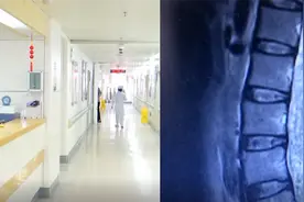 男子走路困难，核磁共振发现异常，术中取出活体绦虫视频封面
