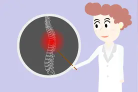 胸椎压缩性骨折如何恢复？其恢复程度与骨折程度有关视频封面
