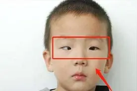 5岁男孩长期玩手机，黑眼珠逐渐“消失”，医生说一般很难恢复`视频封面