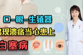 女子口腔溃疡反复发作，以为只是上火没当回事，不料患上白塞病！视频封面