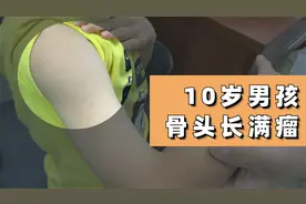 10岁男孩，右手骨头长满肿瘤，肢体严重短缩！母亲担忧急求医视频封面