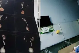 河南一男子检查肾结石，意外发现三个肾，医生：身体正常视频封面