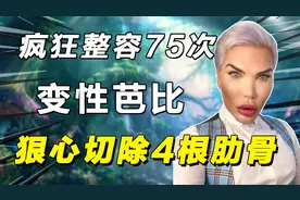 变性芭比：疯狂整容75次，花25万切除4根肋骨，如今身价超过2亿
