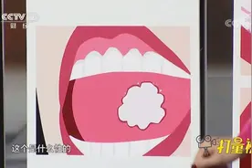 口腔溃疡别大意，呈现这种性状的，警惕是口腔癌|职场健康课视频封面