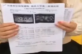 18岁女子怀8胎 系不规范使用排卵药物导致视频封面